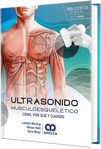 Ultrasonido musculoesquelético. Cómo, por qué y cuándo