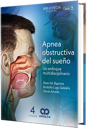 Apnea obstructiva del sueño. Un enfoque multidisciplinario