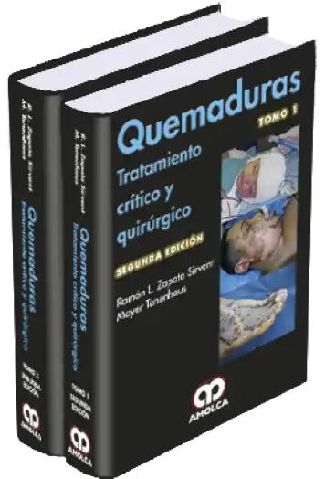 Quemaduras. 2 Edición