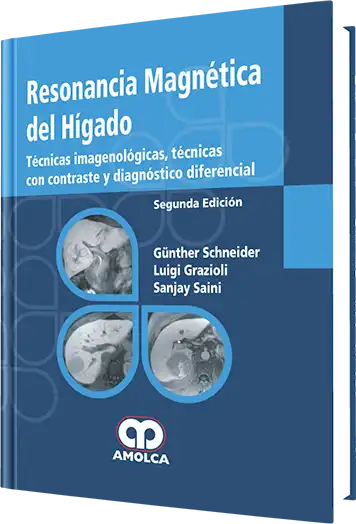 Resonancia Magnética del Hígado 2 Edición