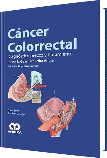 Cáncer Colorrectal