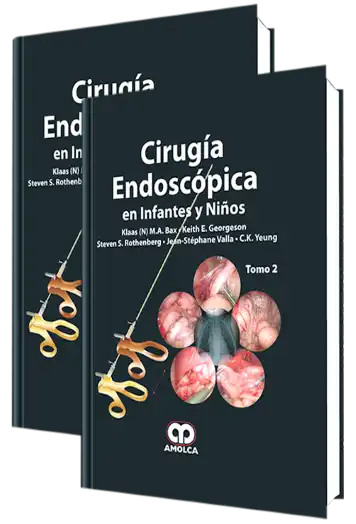 Cirugía Endoscópica en Infantes y Niños