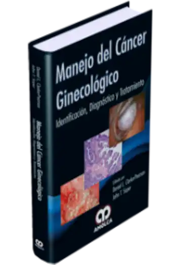 Manejo del Cáncer Ginecológico