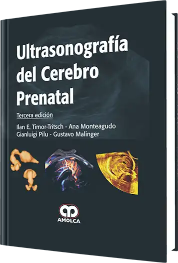 Ultrasonografía del Cerebro Prenatal. 3 Edición