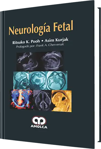 Neurología Fetal