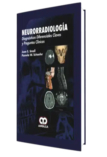 Neurorradiología