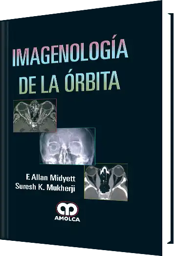 Imagenología de la Órbita