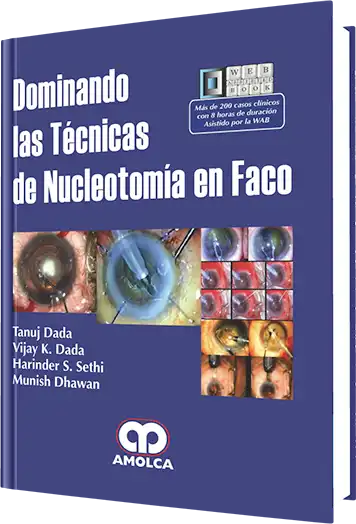 Dominando las Técnicas de Nucleotomía en Faco