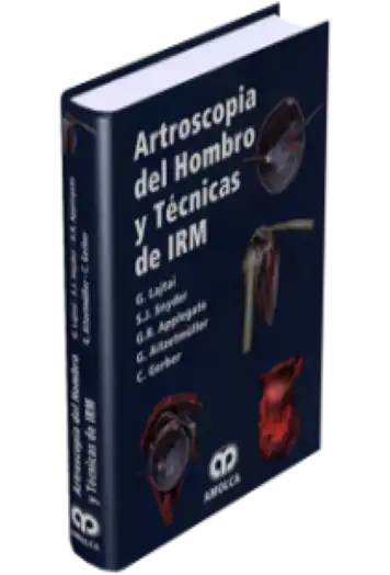 Artroscopia del Hombro y Técnicas de IRM