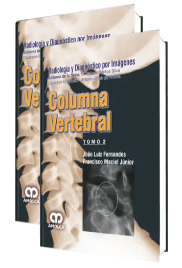 Radiología y Diagnóstico por Imágenes Columna Vertebral