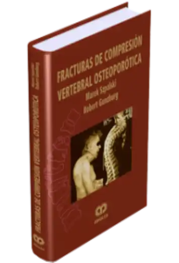 Fracturas de Compresión Vertebral Osteoporótica