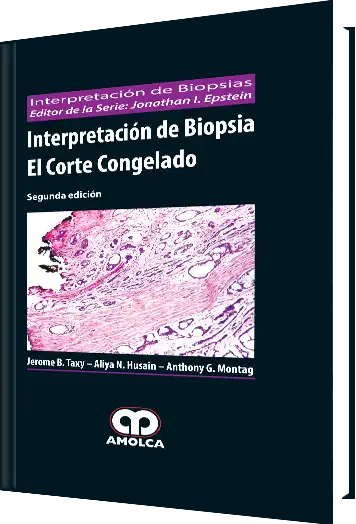 Interpretación de Biopsia el Corte Congelado 2 Edición