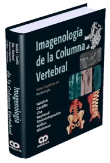 Imagenología de la Columna Vertebral