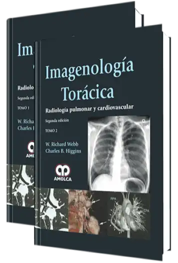 Imagenología Torácica.  Radiología Pulmonar y Cardiovascular 2 Edición