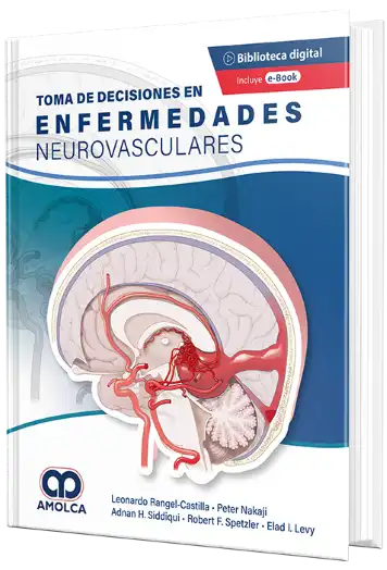 Toma de Decisiones en Enfermedades Neurovasculares