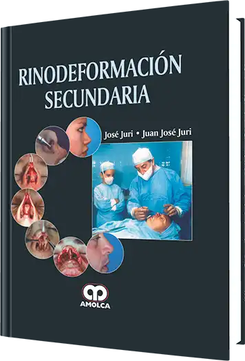 Rinodeformación Secundaria